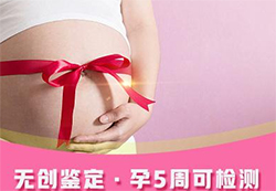 朔州产前亲子鉴定机构结果需要多久，朔州怀孕亲子鉴定哪里可以做